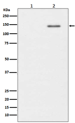 Phospho-SHIP1 (Tyr1020) Recombinant Rabbit Monoclonal Antibody (K01_4M86)