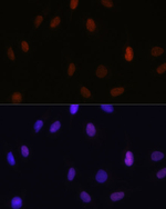 H3K14me1 Antibody in Immunocytochemistry (ICC/IF)