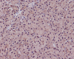 PP1 alpha/beta Recombinant Rabbit Monoclonal Antibody (K01_4N01)