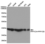 PP1 alpha/beta Antibody in Western Blot (WB)