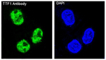 Nkx2.1 Recombinant Rabbit Monoclonal Antibody (K01_4N02)