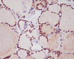 Nkx2.1 Antibody in Immunohistochemistry (Paraffin) (IHC (P))