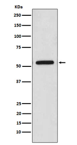 CaMKII Pan Recombinant Rabbit Monoclonal Antibody (K01_4N16)