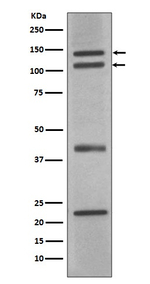 nNOS Antibody in Western Blot (WB)