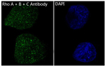RhoA/RhoB/RhoC Recombinant Rabbit Monoclonal Antibody (K01_4N20)