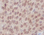 RhoA/RhoB/RhoC Antibody in Immunohistochemistry (Paraffin) (IHC (P))