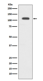 GART Antibody in Western Blot (WB)
