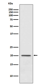 ARF1 Recombinant Rabbit Monoclonal Antibody (K01_4N27)