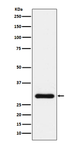 BNP Recombinant Rabbit Monoclonal Antibody (K01_4N46)
