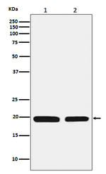 Ferritin Light Chain Recombinant Rabbit Monoclonal Antibody (K01_4N47)