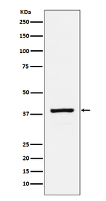 RASSF1 Recombinant Rabbit Monoclonal Antibody (K01_4N48)