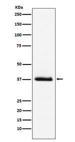 PTH Recombinant Rabbit Monoclonal Antibody (K01_4N49)