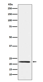 PMP22 Recombinant Rabbit Monoclonal Antibody (K01_4N51)