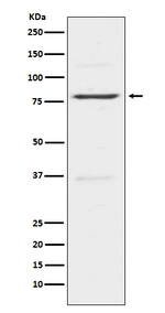 INSRR Recombinant Rabbit Monoclonal Antibody (K01_4N54)