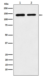 STAG2 Recombinant Rabbit Monoclonal Antibody (K01_4N56)