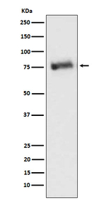 GRK3 Recombinant Rabbit Monoclonal Antibody (K01_4N59)