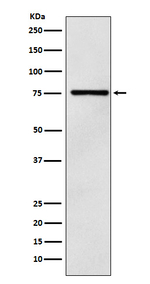 DCP1A Recombinant Rabbit Monoclonal Antibody (K01_4N61)