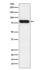 Human IgD Antibody in Western Blot (WB)