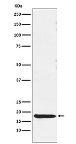 TSH beta Recombinant Rabbit Monoclonal Antibody (K01_4N66)