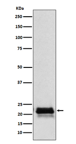 FSH beta Recombinant Rabbit Monoclonal Antibody (K01_4N67)