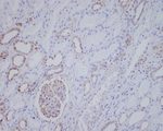 ALK Recombinant Rabbit Monoclonal Antibody (K01_4N68)
