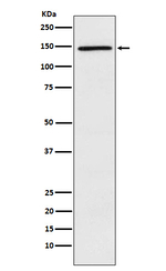 PLCG2 Recombinant Rabbit Monoclonal Antibody (K01_4N72)