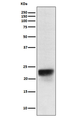 FSH beta Recombinant Rabbit Monoclonal Antibody (K01_4N74)