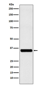 EXOSC7 Recombinant Rabbit Monoclonal Antibody (K01_4N78)