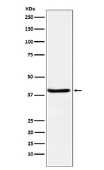 SERPINB3 Recombinant Rabbit Monoclonal Antibody (K01_4N82)
