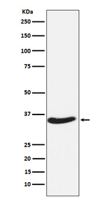 EXOSC7 Recombinant Rabbit Monoclonal Antibody (K01_4N83)