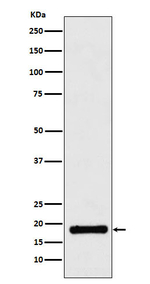 UBE2A/UBE2B Recombinant Rabbit Monoclonal Antibody (K01_4N84)