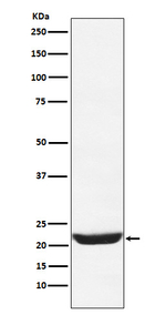 NCS1 Recombinant Rabbit Monoclonal Antibody (K01_4N88)