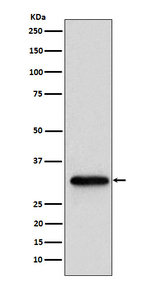 NUDT5 Recombinant Rabbit Monoclonal Antibody (K01_4N90)