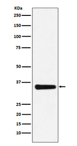 MED4 Recombinant Rabbit Monoclonal Antibody (K01_4N93)