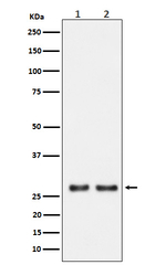 UPP1 Recombinant Rabbit Monoclonal Antibody (K01_4N94)