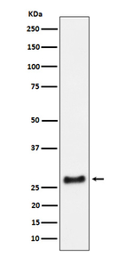 SNRPA1 Recombinant Rabbit Monoclonal Antibody (K01_4N95)