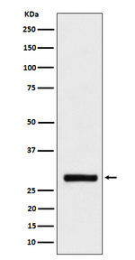 BRMS1 Recombinant Rabbit Monoclonal Antibody (K01_4N99)
