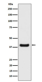 ERLIN2 Recombinant Rabbit Monoclonal Antibody (K01_4P02)