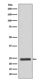 MRRF Recombinant Rabbit Monoclonal Antibody (K01_4P06)