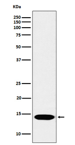 H2BR17me1 Recombinant Rabbit Monoclonal Antibody (K01_4P08)