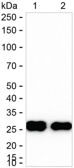 HLA-DMB Recombinant Rabbit Monoclonal Antibody (K01_4P17)