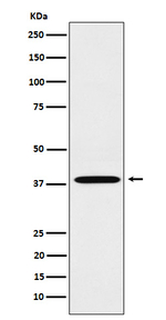 LTB4R Recombinant Rabbit Monoclonal Antibody (K01_4P19)