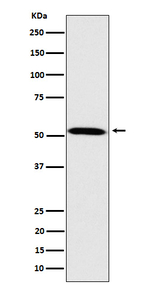 FKTN Recombinant Rabbit Monoclonal Antibody (K01_4P20)