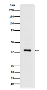ACAT2 Antibody in Western Blot (WB)