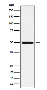 HGD Recombinant Rabbit Monoclonal Antibody (K01_4P22)