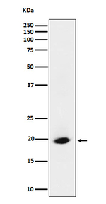 SRP19 Recombinant Rabbit Monoclonal Antibody (K01_4P29)