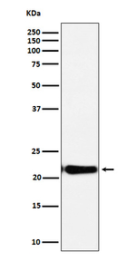 RCL Recombinant Rabbit Monoclonal Antibody (K01_4P31)