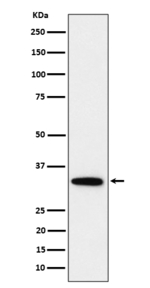 PPP6C Recombinant Rabbit Monoclonal Antibody (K01_4P40)