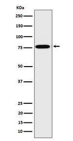 DPP3 Recombinant Rabbit Monoclonal Antibody (K01_4P42)