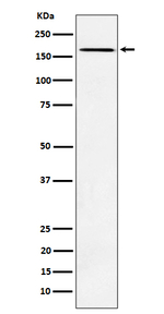 AGL Recombinant Rabbit Monoclonal Antibody (K01_4P43)